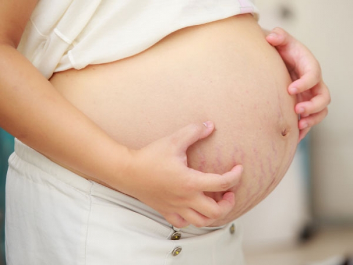 Phát ban ngứa khi mang thai: Nguyên nhân và cách điều tri tận gốc